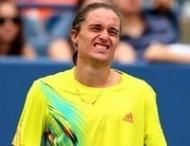 Долгополов обжег лицо на&nbsp;Australian Open (фото)