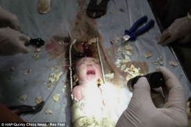 В Китае спасли новорожденного, застрявшего в канализационной трубе
