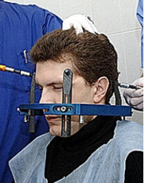 Вчера в столичном институте нейрохирургии первому пациенту сделали операцию на головном мозге с помощью линейного ускорителя «Трилоджи»