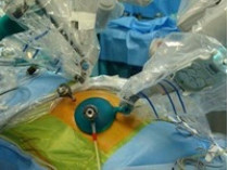 В Италии робот впервые пересадил поджелудочную железу