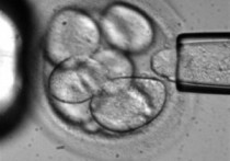 В США из замороженного 20 лет назад эмбриона на свет появился здоровый ребенок
