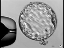 В США начаты испытания эмбриональных клеток на людях
