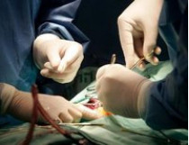 Американские хирурги установили рекорд, пересадив пациентам 16 почек по принципу домино