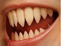зубы укус