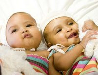 Британские хирурги разделили сиамских близнецов, сросшихся в области головы