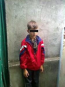 Крымские спасатели освободили 11-летнего мальчика, которого отец за шею приковал цепью к батарее