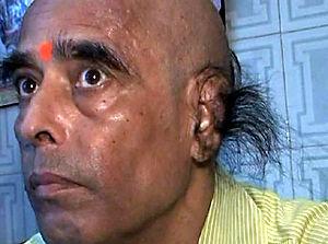 Житель индии установил мировой рекорд, отрастив в ушах волосы длиной 28 сантиметров