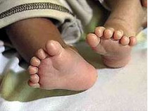 В америке родился мальчик, на руках и ногах которого по шесть пальцев
