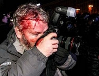 избитый журналист Беркут