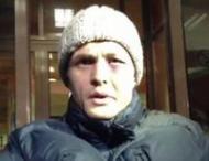 Игорь Луценко восстанавливается после похищения в&nbsp;киевской клинике (фото, видео)