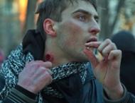 В&nbsp;Днепропетровске по&nbsp;протестующим открыли огонь из&nbsp;травматического оружия (видео)