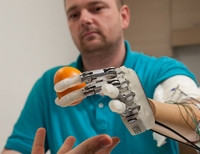 Деннис Аабо бионическая рука