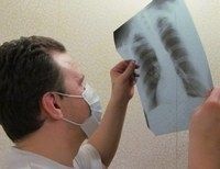 В ближайшие дни в Киеве можно бесплатно провериться на туберкулез 