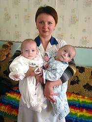 «двойняшки выглядели ужасающе&nbsp;— в шесть месяцев малыши весили всего три килограмма! »