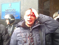 Одесская милиция не нашла подозреваемых в избиении журналистов под обладминистрацией