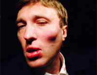 На Киевщине жестоко избили кандидата в депутаты