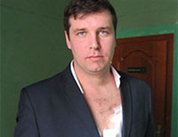 Мэр Полтавы разорвал рубашку на депутате горсовета и поцарапал ему грудь (фото)