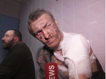 В ОБСЕ отреагировали на сюжет LifeNews о плененных украинских солдатах