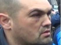 Amnesty International осудила жестокое избиение пленного «киборга» в Донецке (видео)