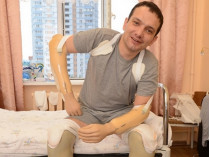 Вадим Свириденко на протезах