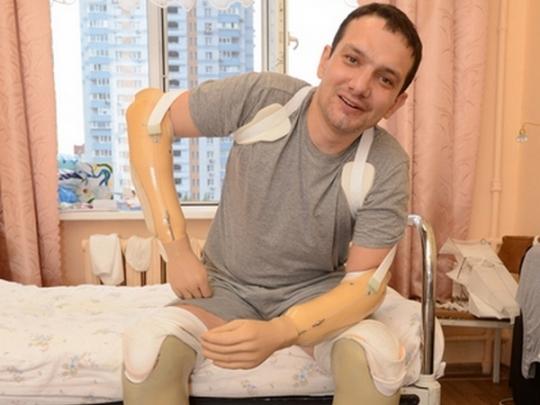Вадим Свириденко на протезах