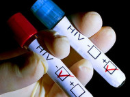 У киевлян и гостей столицы до 28 мая есть возможность бесплатно пройти тест на ВИЧ-инфекцию