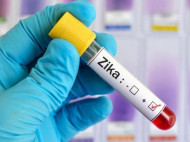 Зарегистрирован первый в Европе случай рождения ребенка с микроцефалией, вызванной вирусом Зика 
