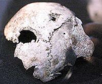 Хранящийся в архиве фрагмент черепа адольфа гитлера на самом деле принадлежал&#133; Женщине