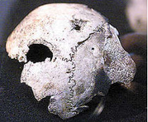 Хранящийся в архиве фрагмент черепа адольфа гитлера на самом деле принадлежал&#133; Женщине