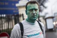 Навального прооперировали в Барселоне, зрение восстановится не сразу