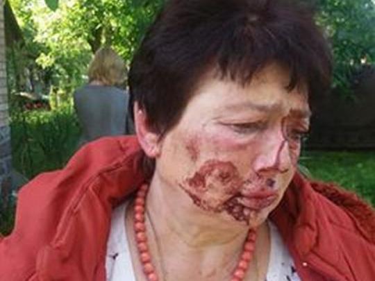 В Киевской области жестоко избили главу теризбиркома