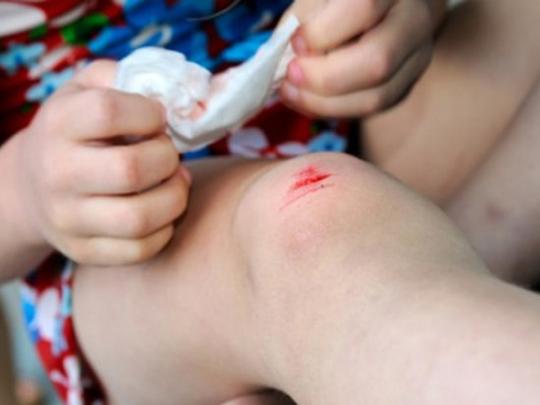 Ребенок поранил ногу