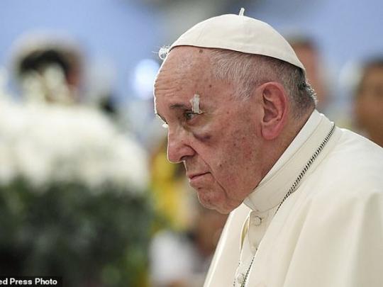 Папа Римский получил травму во время визита в Колумбию (фото, видео)