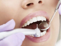 Стоматолог лечит зубы