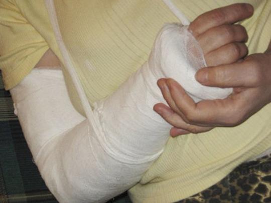 Патрульного, сломавшего руку женщине, повысили в звании и отдали под суд