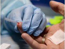 В Николаеве десятки людей госпитализированы с подозрением на гепатит А