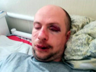 «Я тебе ноги переломаю»: жена избитого под Киевом ветерана АТО рассказала об угрозах 