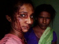 В Индии девушка осталось в живых после того как избила палкой тигра, напавшего на её козу
