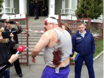 Стрельба у «дома Арбузова» в Киеве: есть пострадавшие