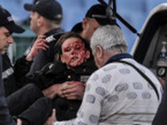 Женщину-полицейского изрешетило осколками стекла после взрыва на футбольном матче в Болгарии (видео)
