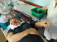 В Кременчуге жестоко избит местный активист