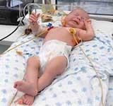 Чтобы спасти жизнь четырехмесячной киевлянке, донецкие врачи ввели ей в сердце 20 миллионов стволовых клеток, выращенных из ее собственного костного мозга в лаборатории
