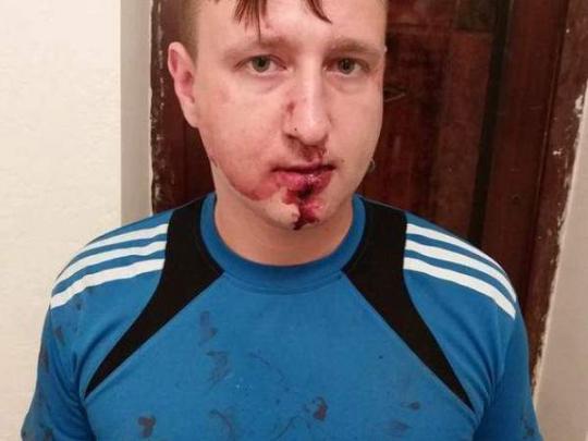 В Одессе неизвестные жестоко избили журналиста