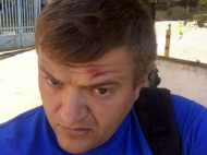 Херсонского журналиста избили одесские «титушки»? (фото)