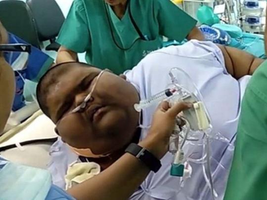 Самый толстый подросток в мире Михир Джанин