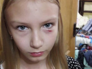 В Киеве пенсионерка жестоко избила девочку-подростка: в сети показали фото