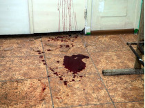 Вооруженные бандиты разгромили отделение больницы и жестоко избили анестезиолога