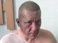 Треш в Донецке: одного из бывших главарей "ДНР" обвиняют в инсценировке покушения на самого себя