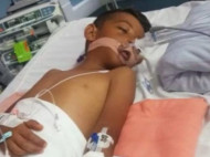 Семилетний мальчик перенес инсульт в результате пищевого отравления в отеле Хургады 