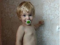 В Запорожье на двухлетнего малыша опрокинулась кастрюля с кипятком (фото)